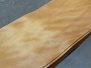 Veneers-2015